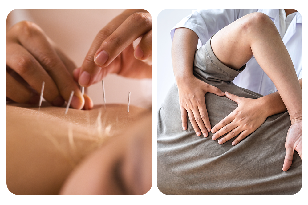 A physiotherapist performing acupuncture and manual treatment